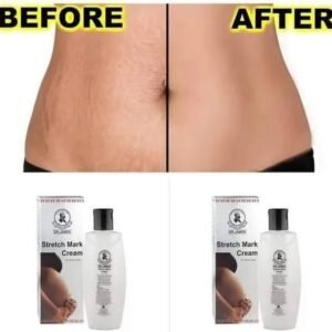 Dr James Stretch Mark Cream